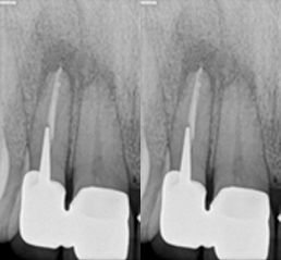 Endodontie - Traitement - Praticien5